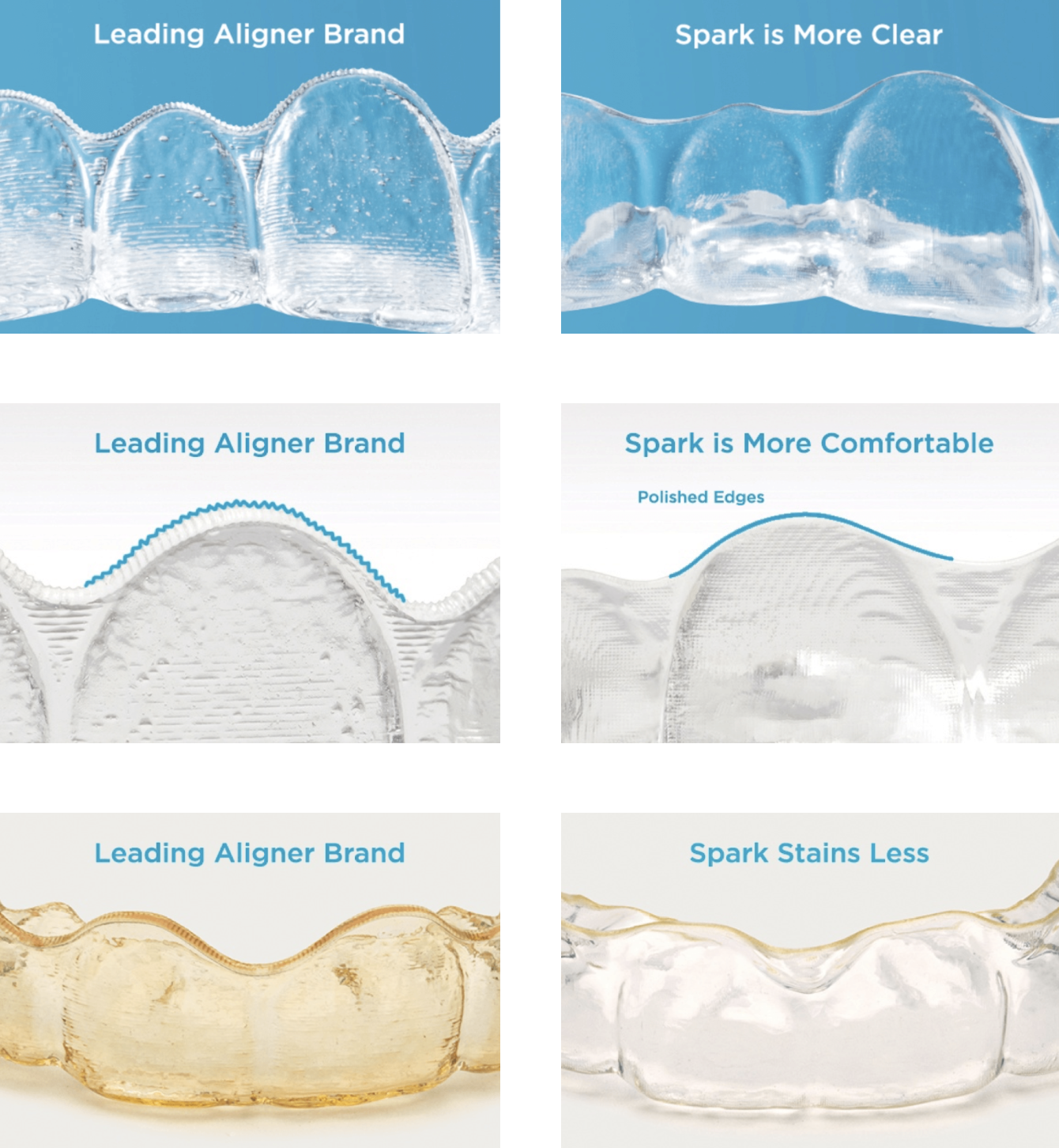 Comparison showing Spark is more clear, more comfortable, and stains less than leading aligner