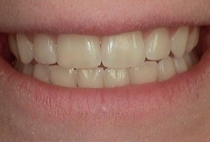 Before Dental Surgery