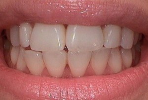 Before Dental Surgery