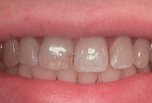 Before Dental Surgery
